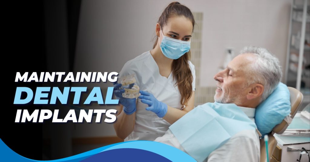 Dental Implants