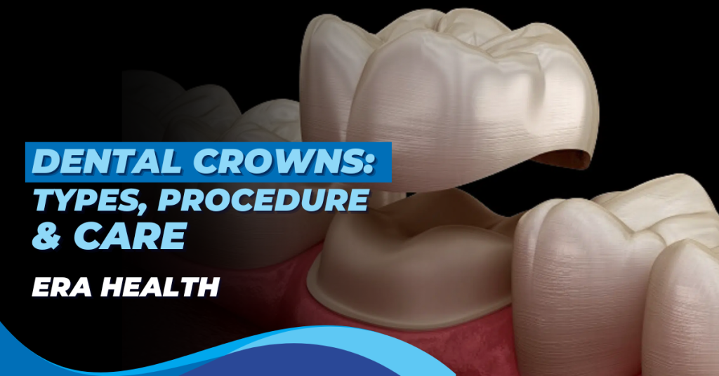 Dental Crowns