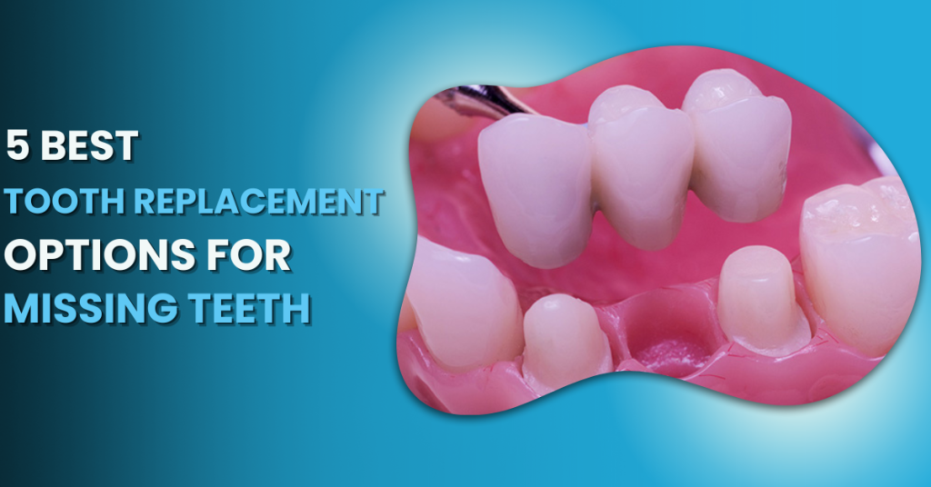 tooth replacement