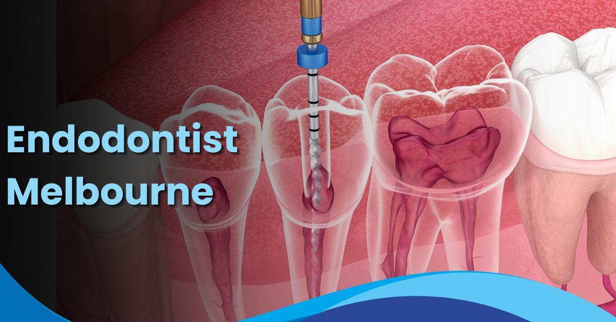 Endodontist Melbourne