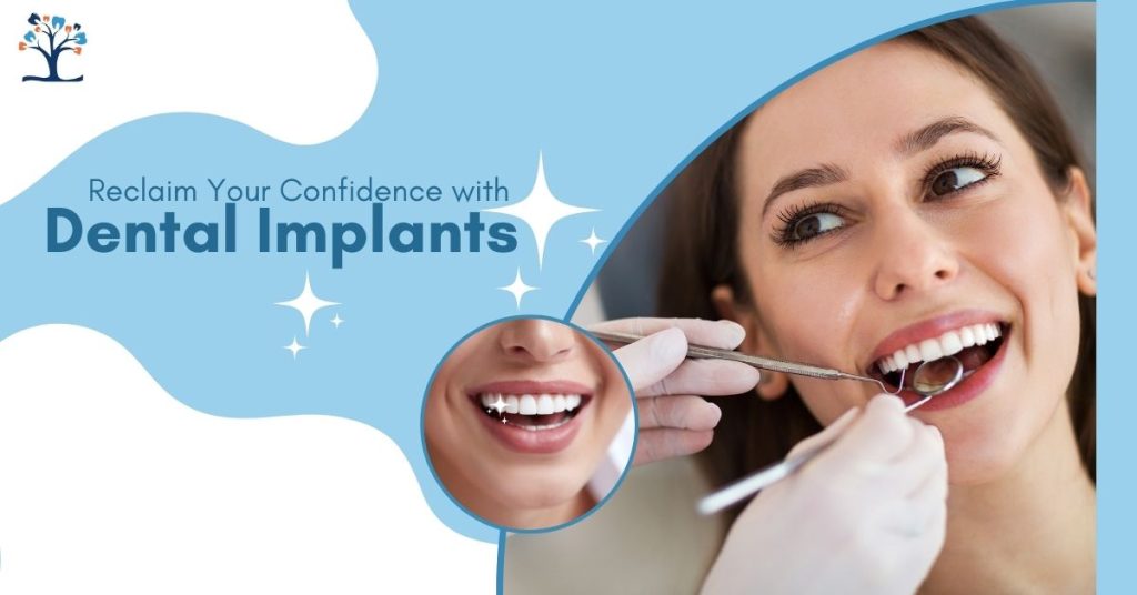 Dental Implants