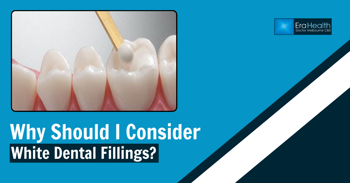 White Dental Fillings