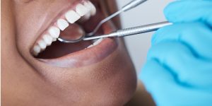 A close up of a man having his teeth cleaned by a dentist.