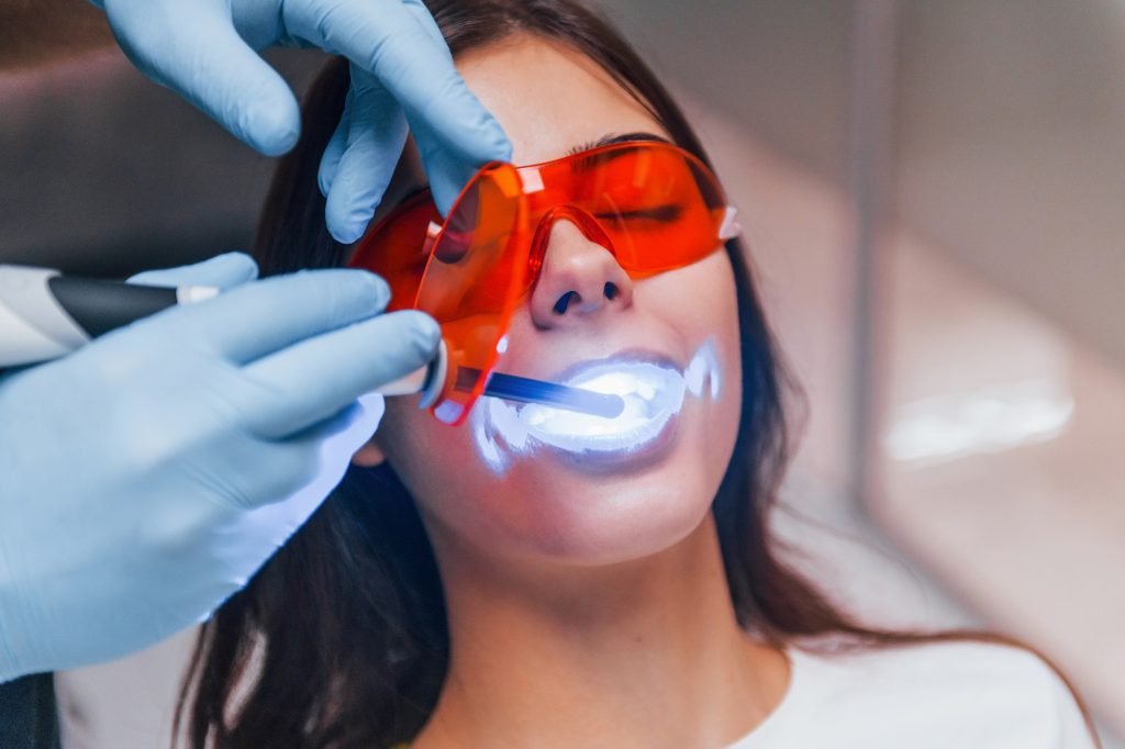 Teeth Whitening in Melbourne