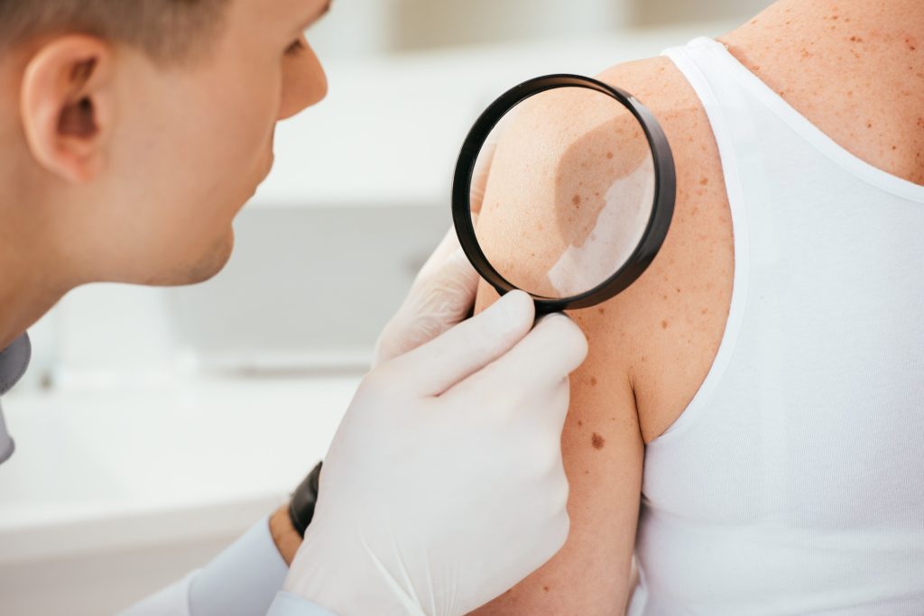 Skin Cancer Checks