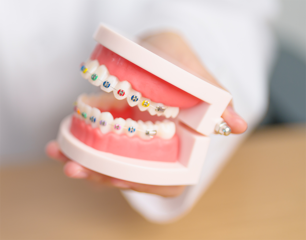 close braces