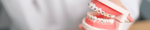 dental braces