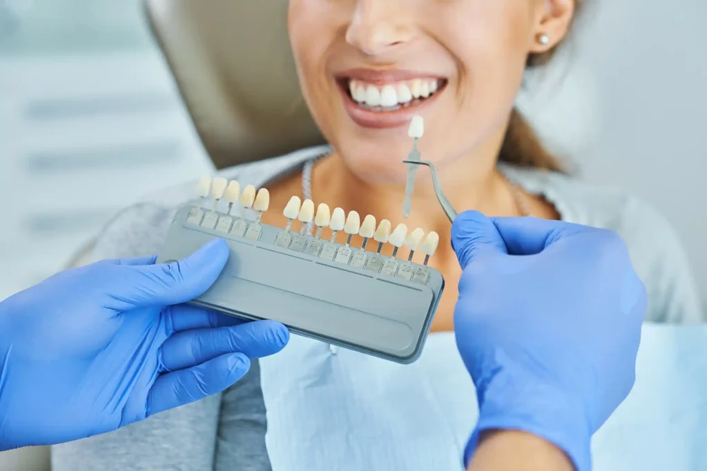 Porcelain Veneers2
