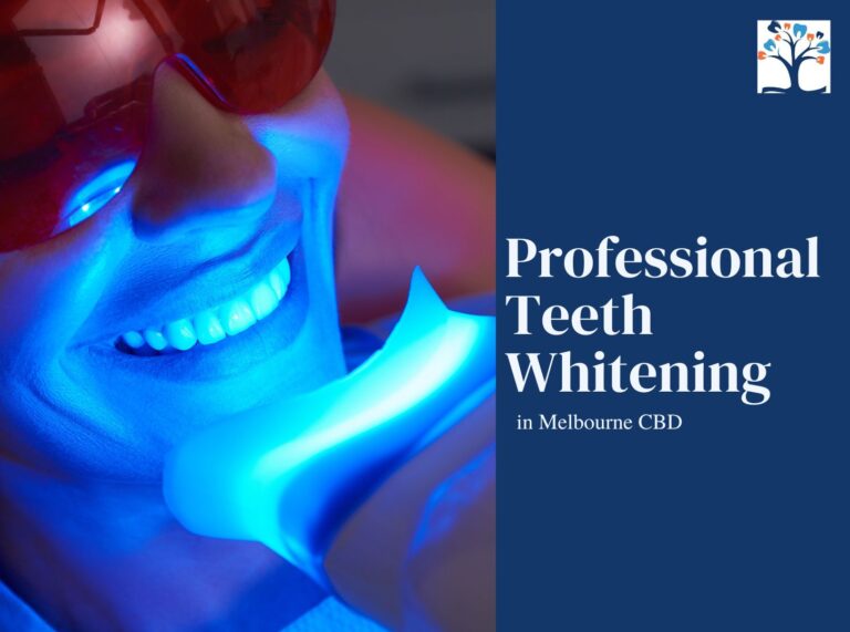 Professional-Teeth-whitening-768x571