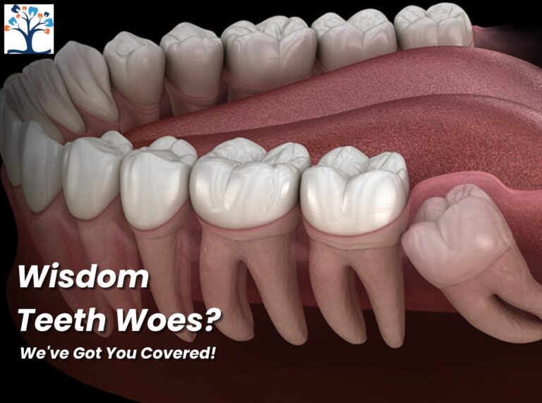 Wisdom-Tooth-Extraction