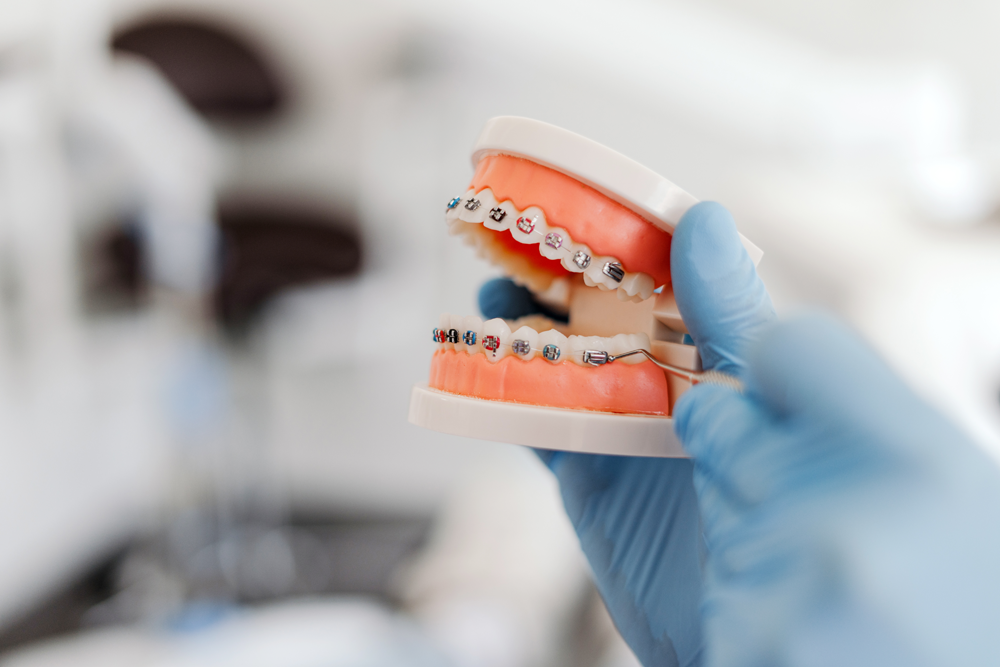 closeup-dentist