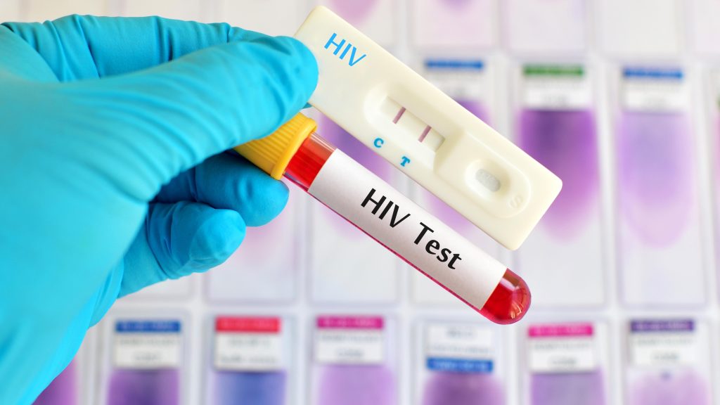 HIV virus, medical