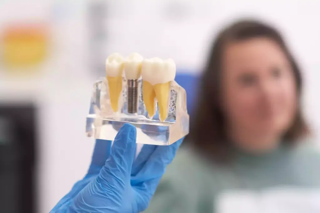 Dental Crowns