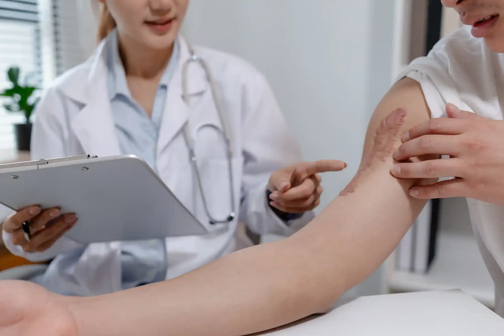 Skin Cancer Check Melbourne CBD