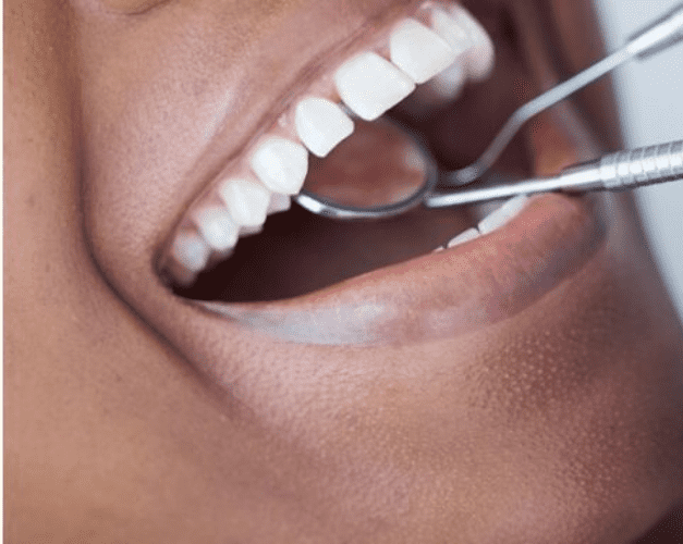 A man having his teeth looked at by a dentist